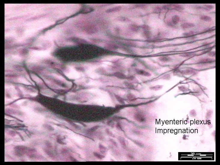 NERVOUS TISSUE - 33-Myenteric Plexus -B.jpg